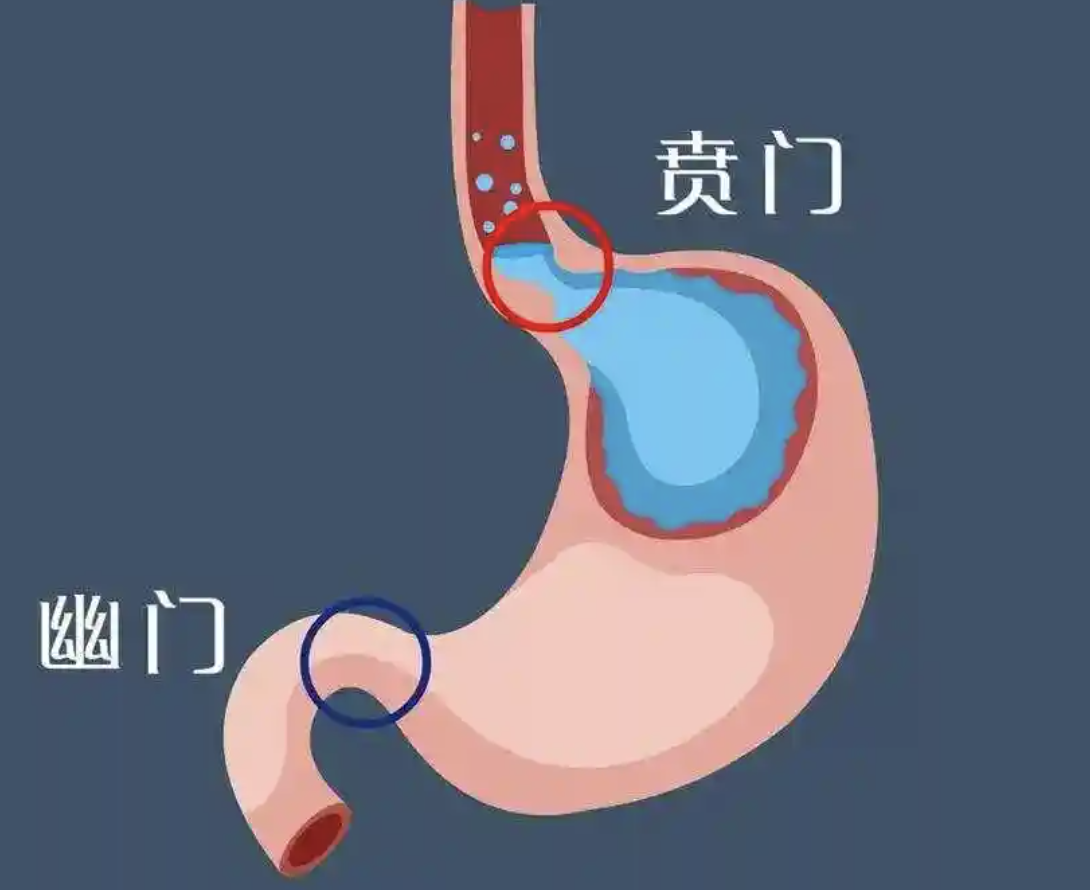 了解贲门癌：早期诊断与有效预防封面图