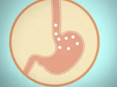 震惊！贲门癌患者如何自我保护？这些方法一定要知道！