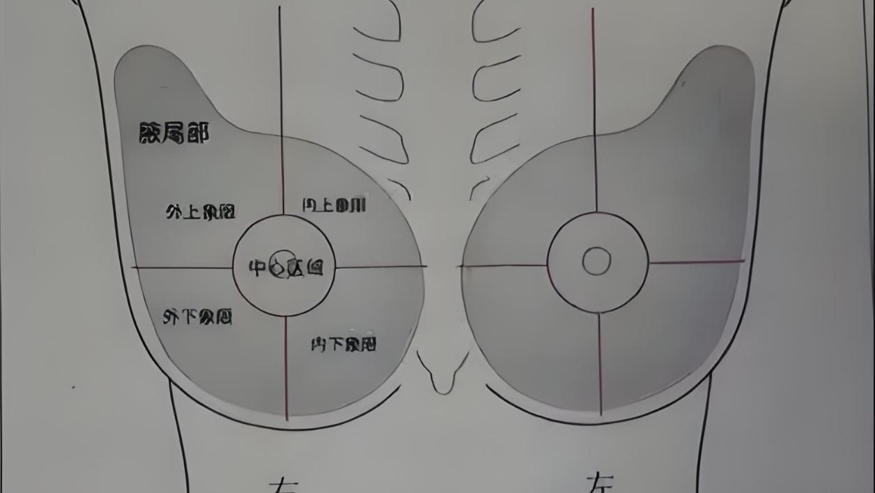 乳腺肿瘤：不仅仅是肿块！深度解析及预防攻略封面图