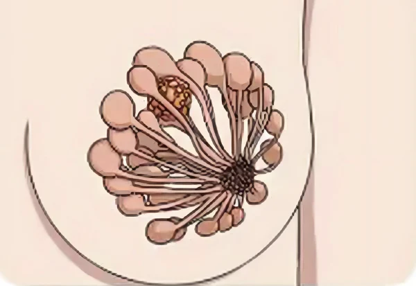 抗击乳腺癌——了解乳腺癌及其预防和治疗的关键