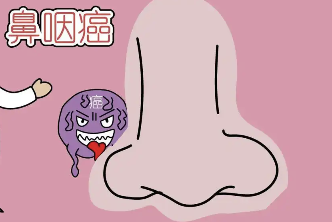 科普，了解鼻咽癌：从诊断到治疗的全方位指南封面图