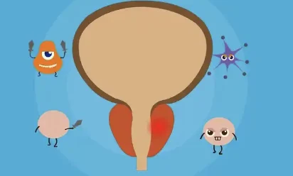 前列腺增生：老年男性不可忽视的健康隐患！