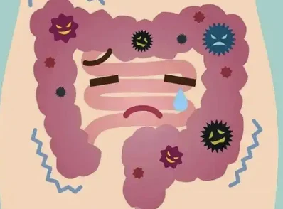 结直肠癌的检测与防治:专业指南