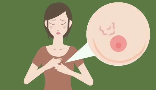 全面解析乳腺癌:疾病认知与科学管理