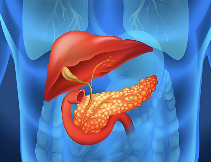 全面解析胰腺癌：诊断与治疗全攻略