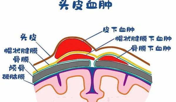 头皮裂伤老年患者的麻醉管理:如何平衡风险与安全?