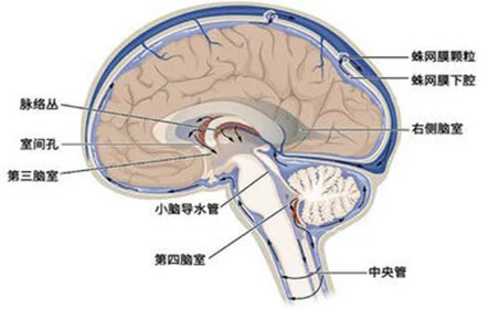 重症蛛网膜下腔出血患者在ICU的管理要点