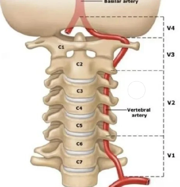 全面解析椎动脉狭窄及相关疾病的诊断与治疗