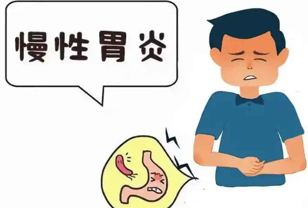 科普，您的胃健康守护：慢性胃炎的预防、症状和治疗指南封面图