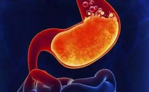 胃肠健康别忽视:胃炎、肠道菌群失调和内痔的全面解析