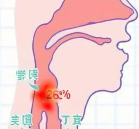 如何应对急性咽炎:从诊断到治疗的全面指南