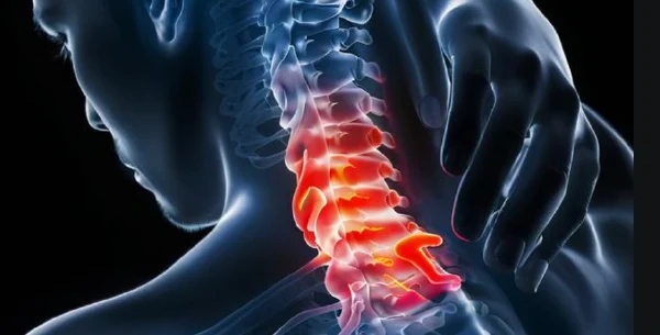 神经根型颈椎病手术麻醉:如何实现精准化与安全性平衡?