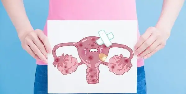 子宫肌瘤手术麻醉:如何确保安全与舒适?