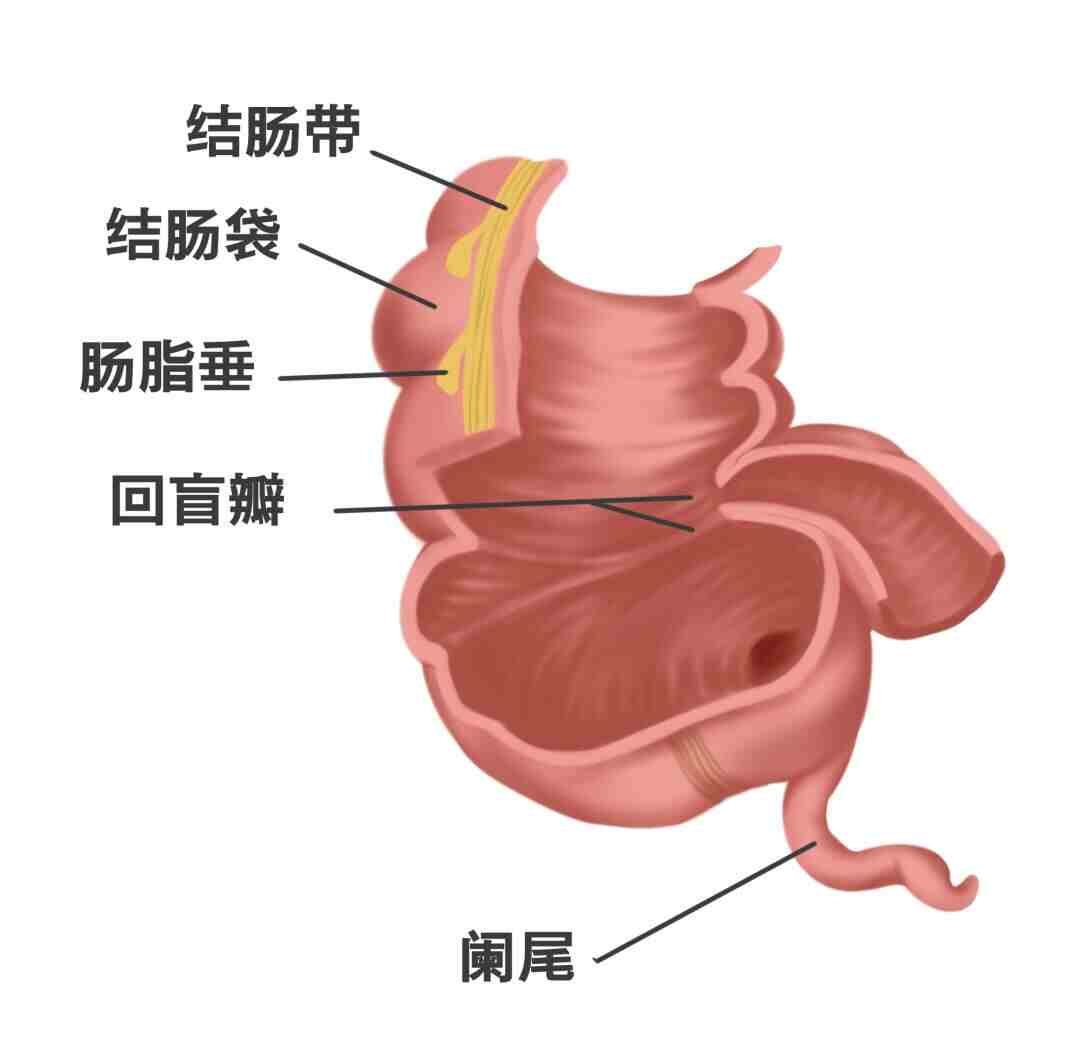 急性阑尾炎的全面解析：从诊断到康复封面图