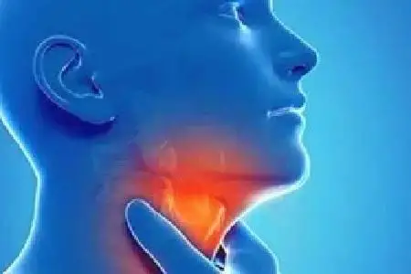 深入了解慢性咽炎:症状、诊断与治疗