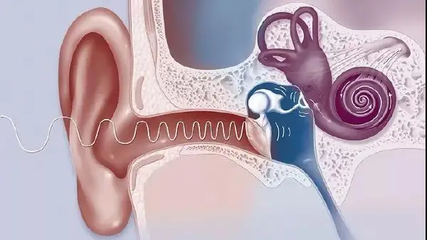 后循环缺血与混合性耳聋：疾病解读与科学管理