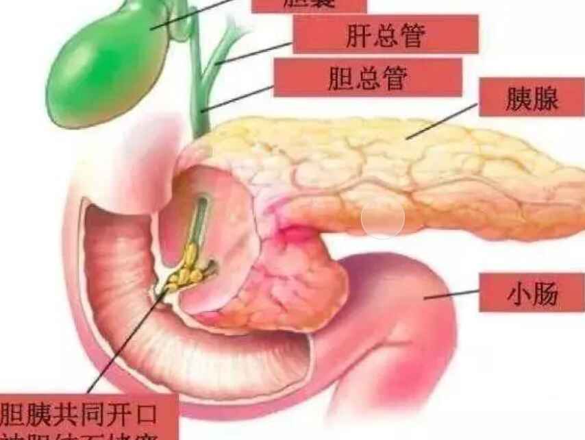 科普，急性胰腺炎的全面管理：诊断、治疗与预防封面图
