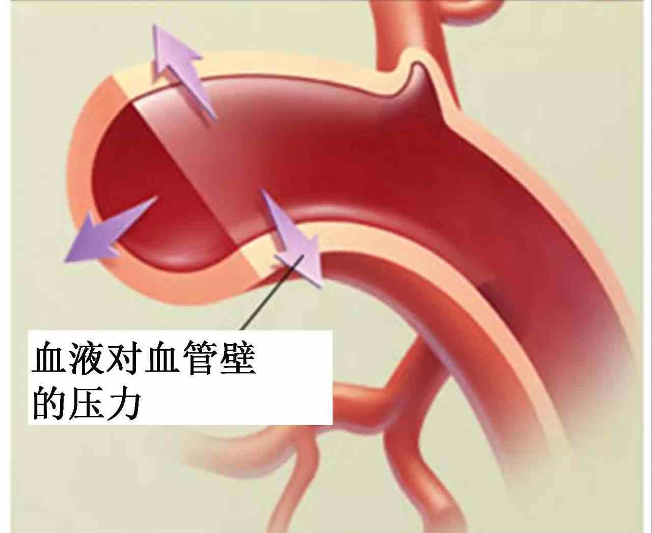 高血压：<span style="color: #da4707">科学</span><span style="color: #da4707">认知</span>与全面管理