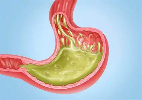 慢性胃炎的全面解析:从病因到日常管理