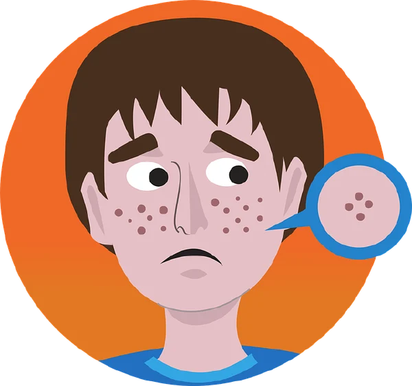 解读痤疮:从成因到综合治疗策略