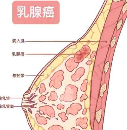 乳腺肿瘤的早期诊断与治疗：科学与<span style="color: #da4707">实践</span>并行