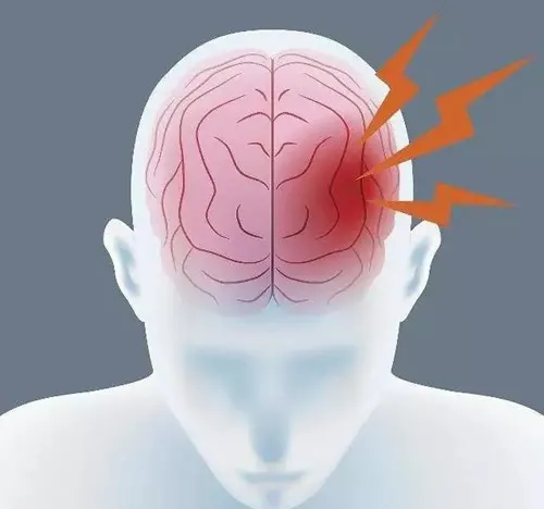 脑内出血的诊断与治疗全解析:从病因到护理的全周期管理