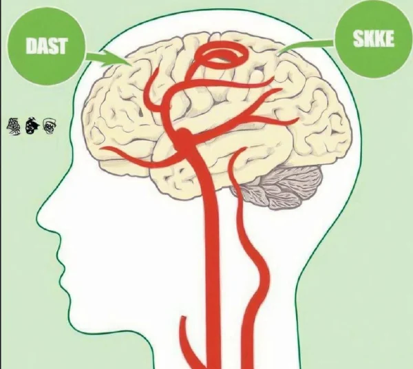全面应对脑梗死：从诊断到管理的详解