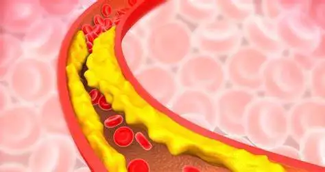 高血脂患者必读:了解你的健康指标,远离健康隐患!