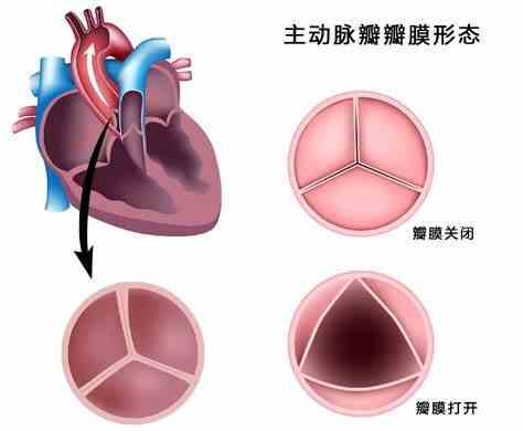 主动脉瓣疾病全解析：从病理解读到现代治疗策略