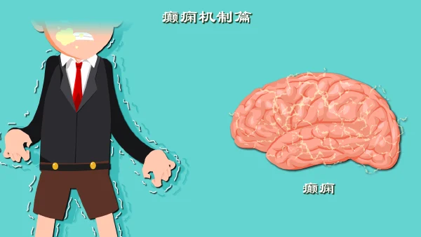 继发性癫痫：全面解析病因、诊断及治疗