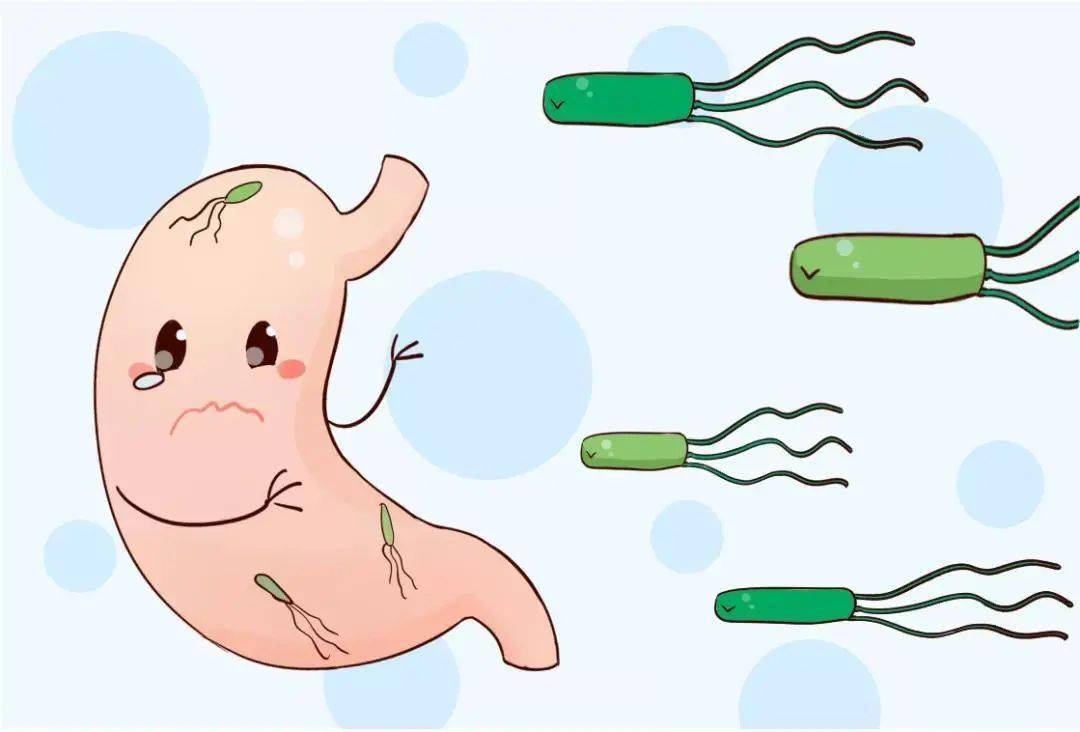 幽门螺杆菌感染与慢性胃炎管理：科学治疗与生活调控