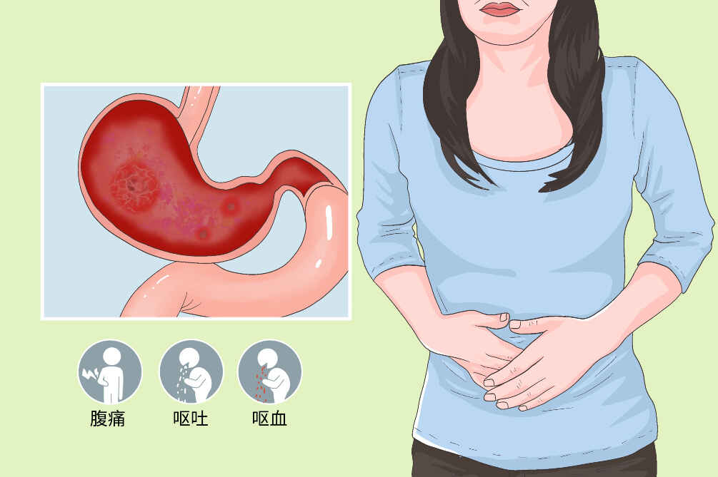 慢性胃炎？！肚子不痛不舒服？赶快了解这些知识！封面图