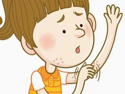 关于荨麻疹：一个需要你多留意的健康问题