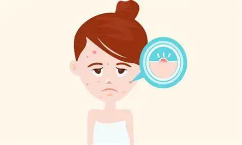 让你措手不及的脂溢性皮炎——别担心,一起看看如何应对!