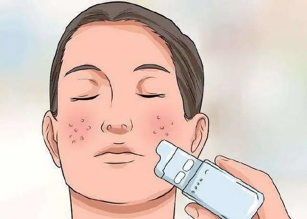 过敏性皮炎：别让皮肤过敏毁了你的健康！