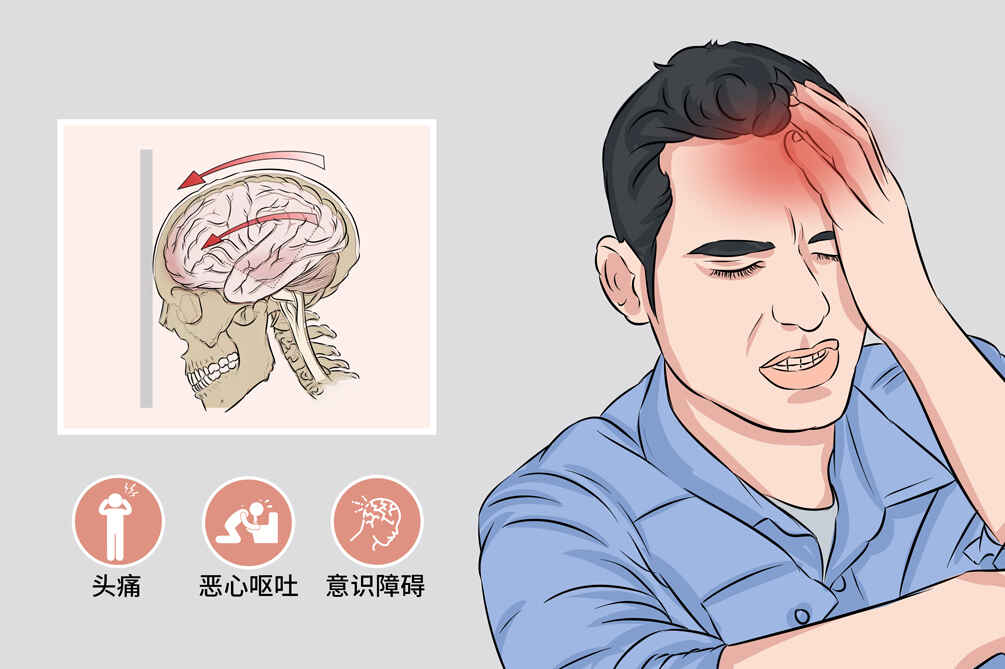 颅脑外伤后的有效管理与治疗指导