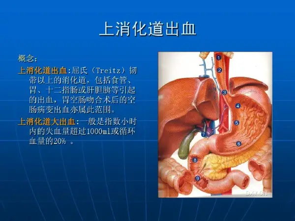急性上消化道出血——老年人常见但易被忽视的健康隐患!