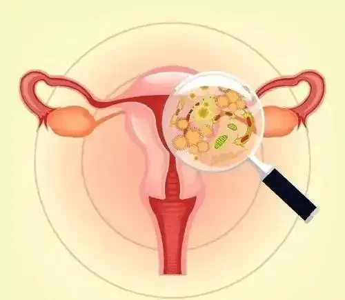 围绝经期综合征：她们的“隐形杀手”，你了解多少？