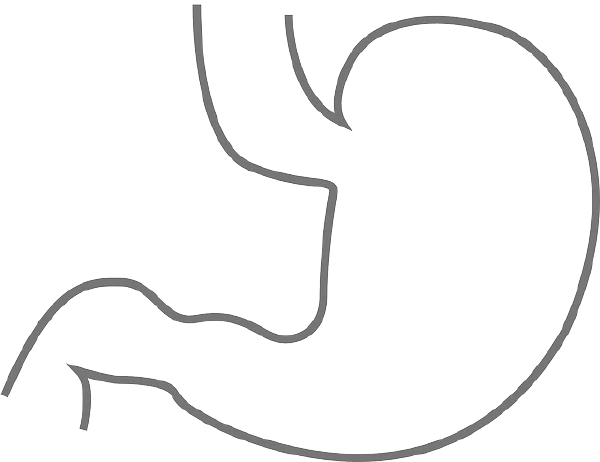 胃间质瘤：识别、治疗与预防