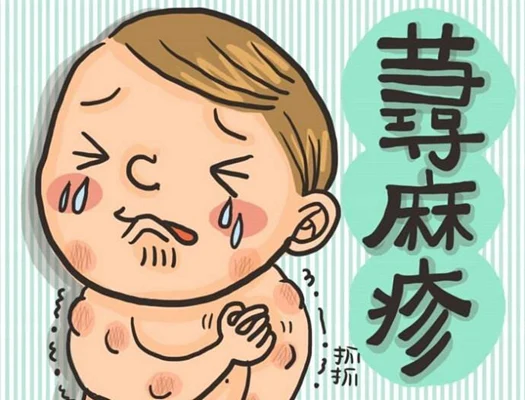 慢性荨麻疹,你了解多少?——常见误区与正确应对