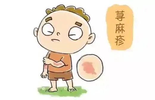慢性荨麻疹诊断报告及预防措施详解封面图