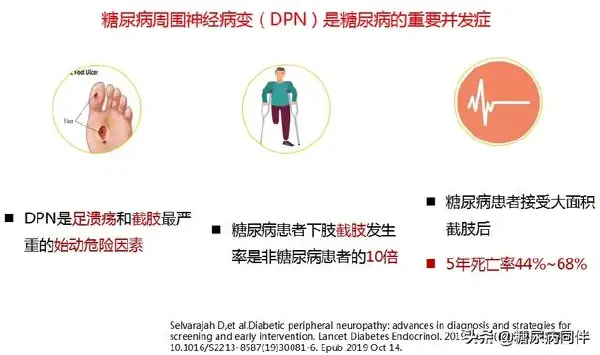 糖尿病神经病变:背后的秘密与防治对策