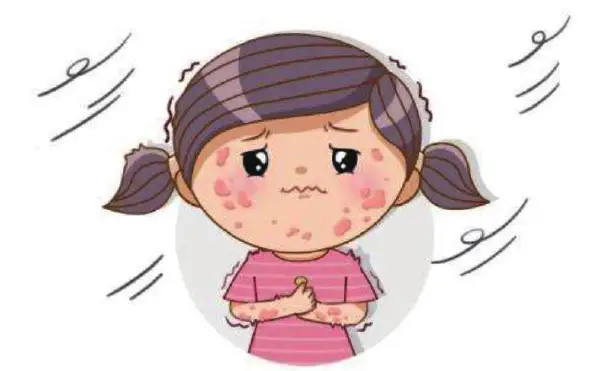 全面解析慢性荨麻疹：从诊断到治疗