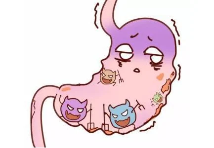 急性肠炎与急性胃炎的诊断与治疗指南