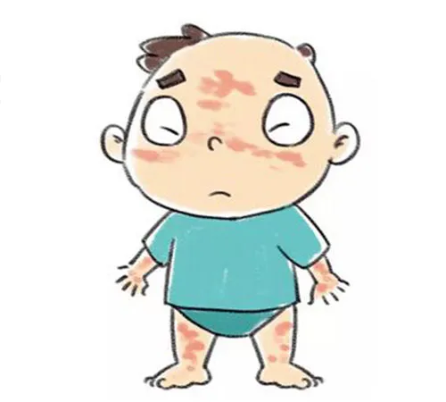 湿疹,别担心!让我们一起了解它