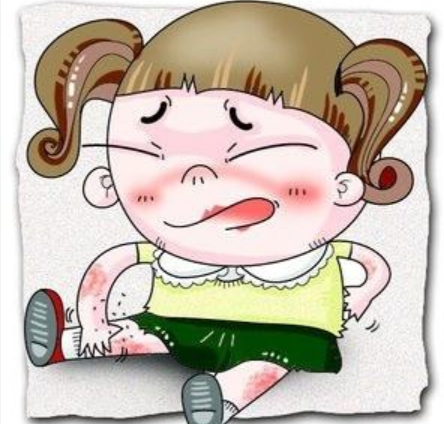 慢性荨麻疹：了解、治疗与预防全指南封面图