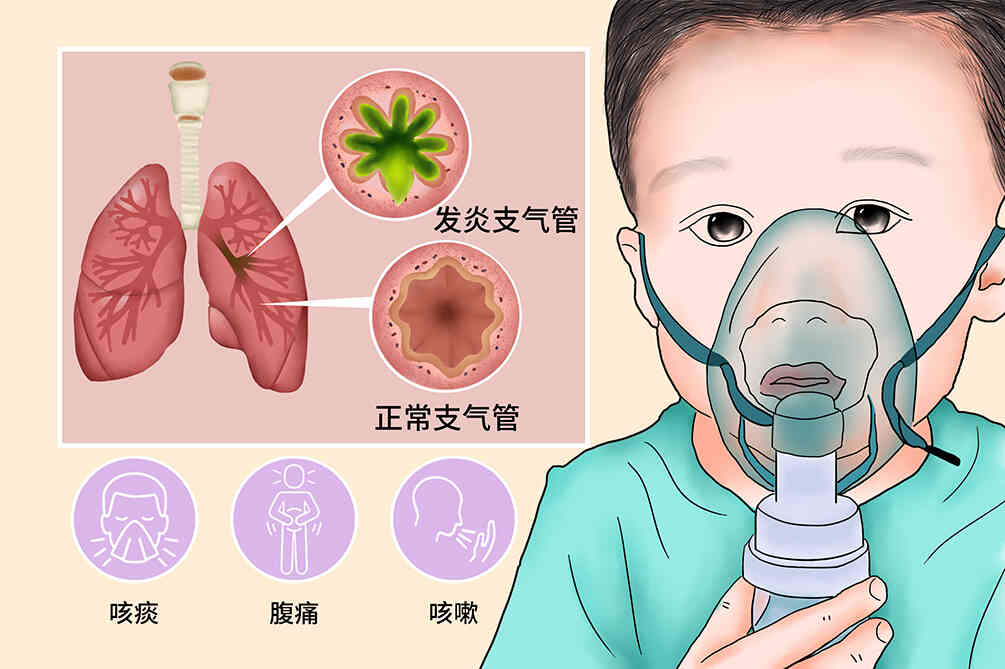 急性支气管炎那些事：从诊断到预防，给健康上一份保险封面图