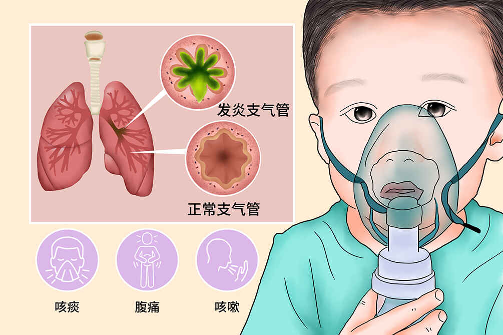 急性支气管炎那些事：从诊断到预防，给健康上一份保险