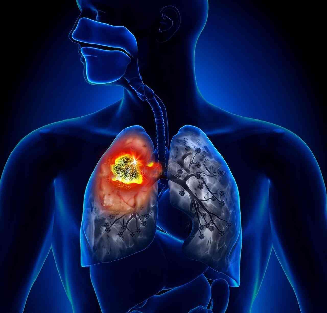 揭示肺与甲状腺健康的科学护航——药物知识你需要知道！封面图