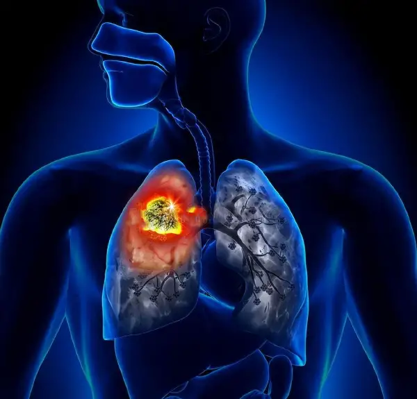 揭示肺与甲状腺健康的科学护航——药物知识你需要知道！